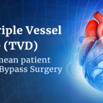 triple-vessel-coronary-artery-disease-and-cardiac-vessel-disease-understanding-the-impact-of-coronary-artery-disease-on-major-vessels