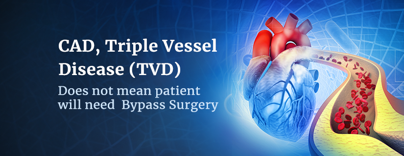 triple-vessel-coronary-artery-disease-and-cardiac-vessel-disease-understanding-the-impact-of-coronary-artery-disease-on-major-vessels